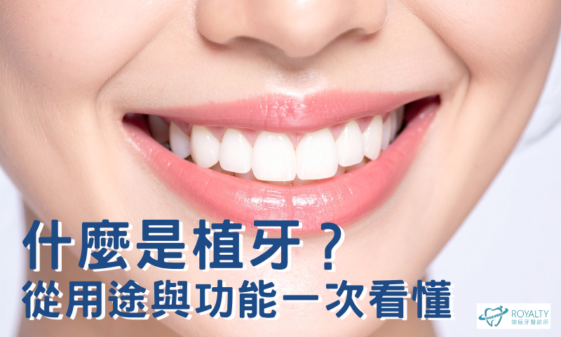 二、什麼是植牙?從用途與功能一次看懂