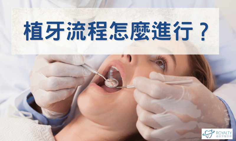 六、植牙流程怎麼進行?從評估到完成一次看懂情境圖