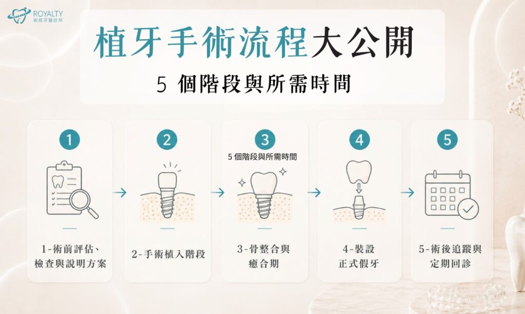 植牙手術流程大公開：5 個階段與所需時間
