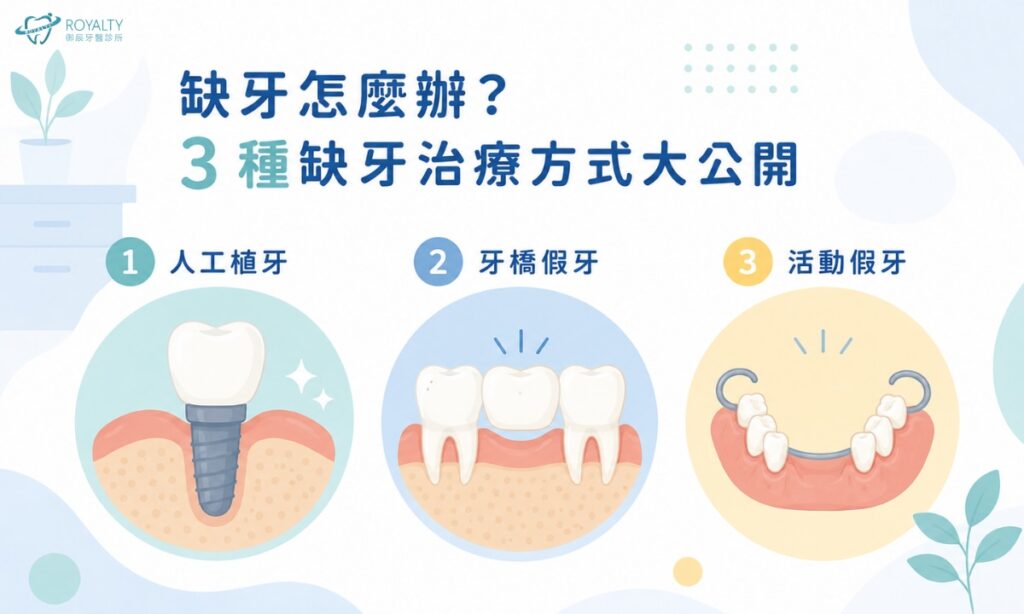 缺牙怎麼辦？3 種缺牙治療方式大公開