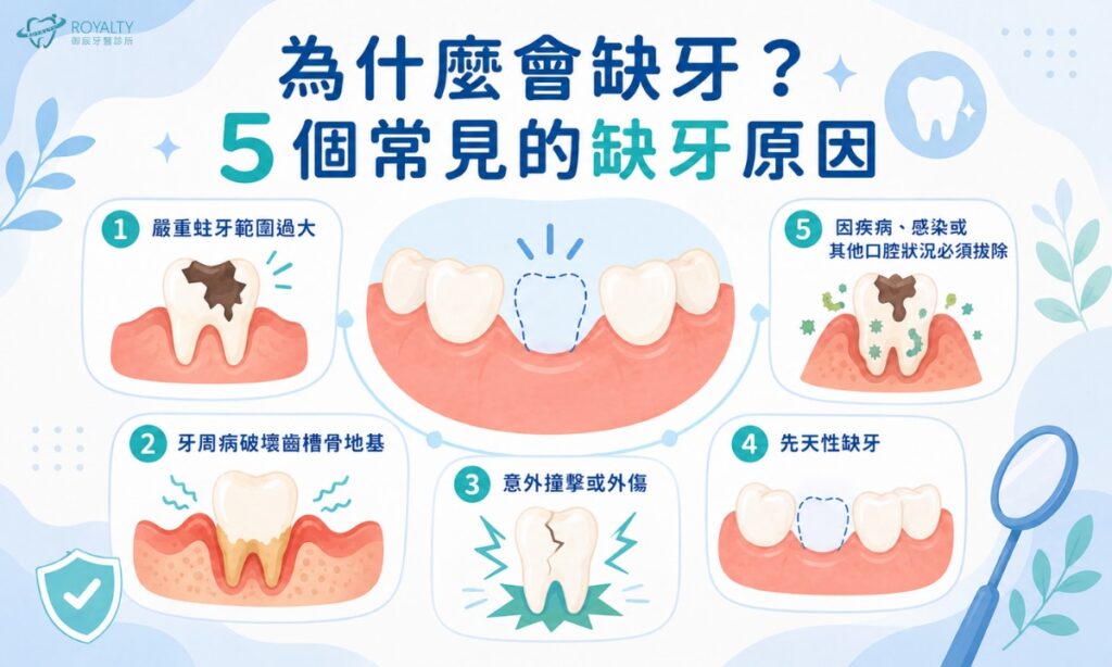 缺牙怎麼辦？先做這3件事，比急著植牙更重要