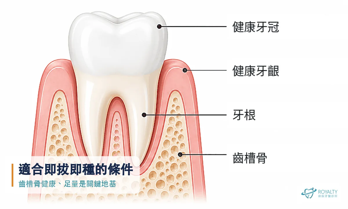健康牙齒剖面圖，標示牙冠、牙齦、牙根與齒槽骨