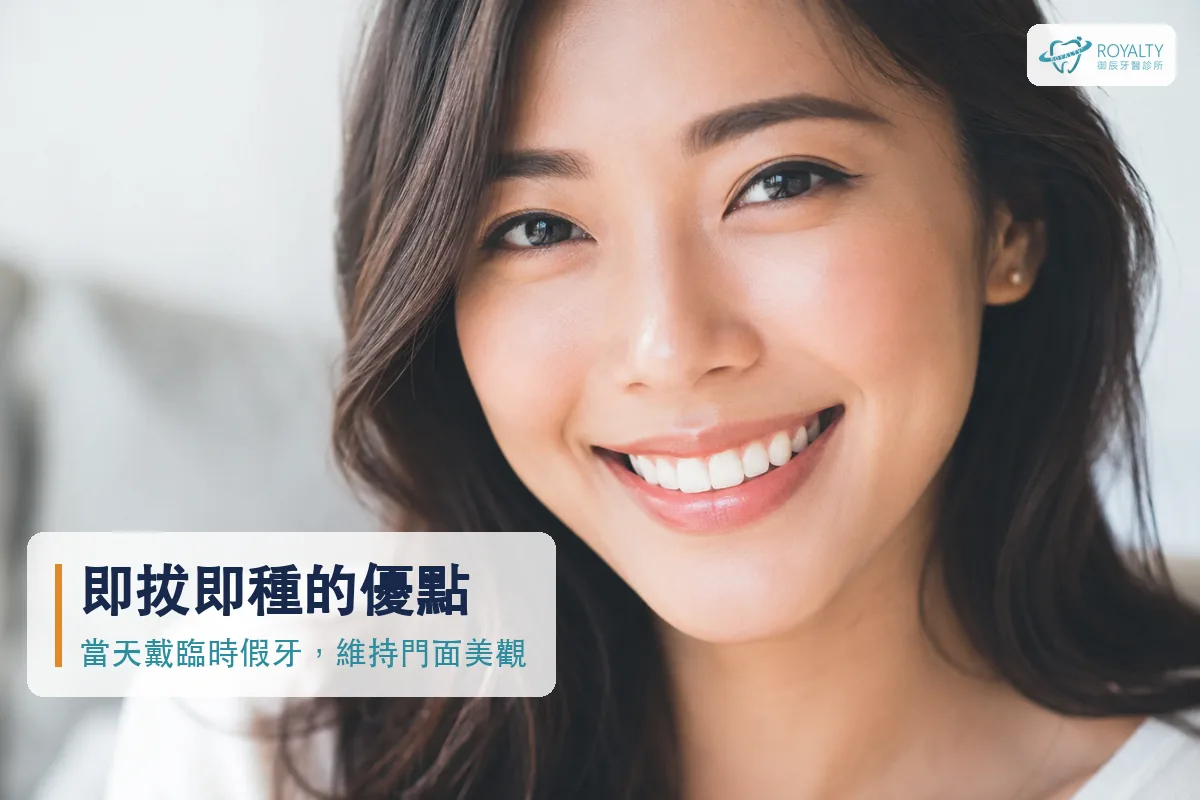 即拔即種當天戴上臨時假牙，維持自然笑容與門面