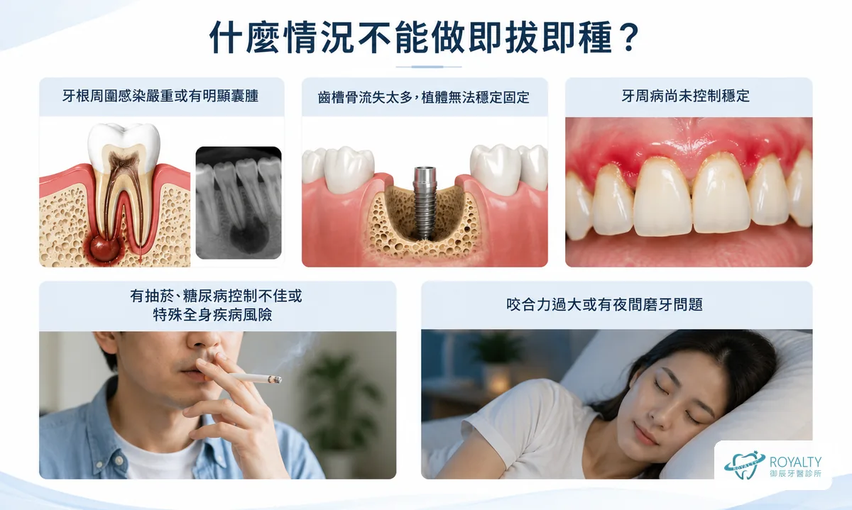 什麼情況不能做即拔即種：牙根感染或囊腫、齒槽骨流失、牙周病未控制、抽菸或糖尿病控制不佳、咬合力過大或夜間磨牙