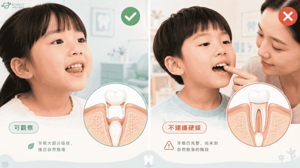 小孩牙齒在搖,可以自己拔嗎?說明圖