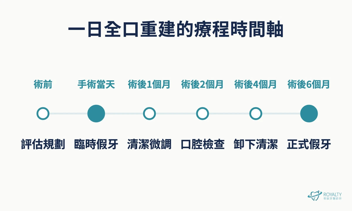 一日全口重建療程時間軸:術前評估、手術當天裝臨時假牙、術後1、2、4個月回診,術後6個月製作正式假牙
