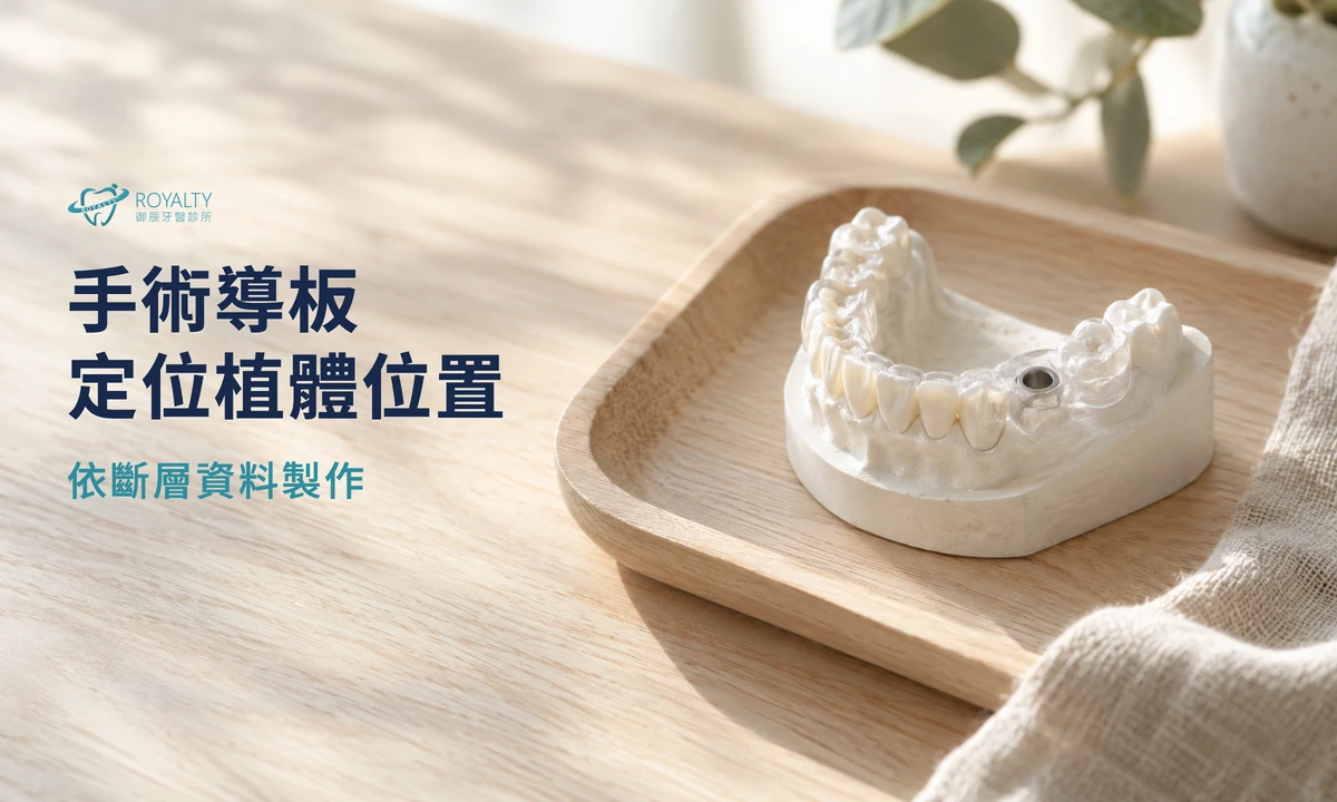 石膏牙齒模型上的透明植牙手術導板